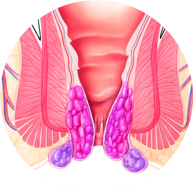 Gelarex łagodzi objawy już od pierwszego użycia